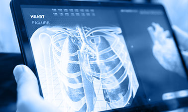 Research: A Streamlined AI System for Automated Diagnosis of Pulmonary Embolism using Chest Images