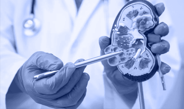 Precision Immunosuppression in Kidney Transplantation: Moving Beyond “Average” Tacrolimus Dosing