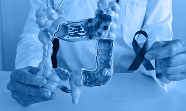 Research : Watchful waiting strategy in rectal cancer