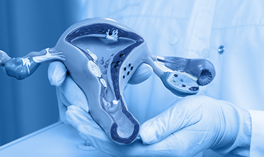 Research : The Shape Trial